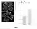 Fig. 07 - METHOD OF DETECTING OCULAR DISEASES AND PATHOLOGIC CONDITIONS AND TREATMENT OF SAME