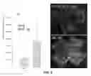 Fig. 08 - METHOD OF DETECTING OCULAR DISEASES AND PATHOLOGIC CONDITIONS AND TREATMENT OF SAME