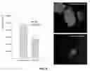 Fig. 09 - METHOD OF DETECTING OCULAR DISEASES AND PATHOLOGIC CONDITIONS AND TREATMENT OF SAME