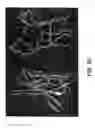 Fig. 46 - Method for treating an autoimmune disease using a soluble CTLA4 molecule and a DMARD or NSAID