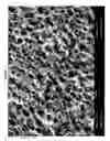 Fig. 04 - Scaffold comprising co-precipitated Collgen and glycosaminoglycan for inhibiting adhesion of body tissue layers
