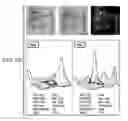 Fig. 06 - Individualized cancer therapy
