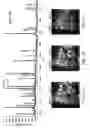 Fig. 07 - Individualized cancer therapy