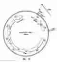 Fig. 20 - Individualized cancer therapy