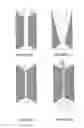Fig. 02 - Meat stretching device and method