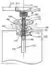Fig. 01 - Method for forming a socket for a dental implant