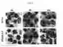 Fig. 06 - PLATELET STABILIZATION