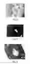 Fig. 04 - ORAL INSULIN COMPOSITION AND METHODS OF MAKING AND USING THEREOF