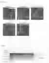 Fig. 07 - Agent for treating polyglutamine aggregation-caused disease or suppressing onset thereof