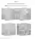 Fig. 02 - METHODS FOR TREATING BONE TUMORS