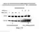 Fig. 89 - Inhibition of apoptosis-specific eIF-5A (