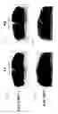 Fig. 09 - METHODS AND COMPOSITIONS FOR THE TREATMENT OF NEUROLOGICAL DISEASE