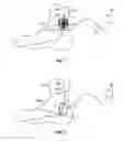 Fig. 02 - METHOD AND APPARATUS FOR MAGNETIC INDUCTION THERAPY