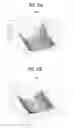 Fig. 09 - ENDOSCOPE AND A METHOD FOR FINDING ITS LOCATION