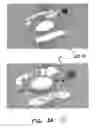 Fig. 07 - View optimizer and stabilizer for use with surgical scopes