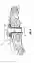 Fig. 07 - SURGICAL ACCESS ASSEMBLY