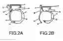 Fig. 03 - RAPIDLY DEPLOYABLE SENSOR DESIGN FOR ENHANCED NONINVASIVE VITAL SIGN MONITORING