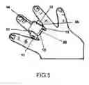 Fig. 06 - RAPIDLY DEPLOYABLE SENSOR DESIGN FOR ENHANCED NONINVASIVE VITAL SIGN MONITORING