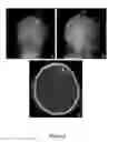Fig. 03 - SYSTEMS AND METHODS FOR MEASURING BRAIN ACTIVITY