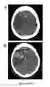 Fig. 16 - SYSTEMS AND METHODS FOR MEASURING BRAIN ACTIVITY