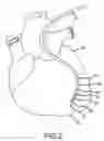 Fig. 03 - Devices and methods for catheter localization