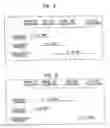 Fig. 03 - Remote sensing catheter system and methods