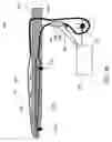 Fig. 06 - Apparatus for Protecting a Cavity Wall During Ablation of Tissue Near the Cavity