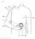 Fig. 06 - PORTABLE ELECTROCARDIOGRAPH