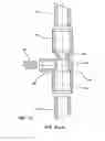 Fig. 09 - Infusion site for improved mixing of fluids