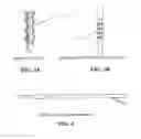 Fig. 03 - APPARATUS AND METHODS FOR TREATING URETHRAL INCONTINENCE