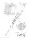 Fig. 02 - IV catheter introducer