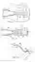 Fig. 09 - Manifolds, systems, and methods for administering reduced pressure to a subcutaneous tissue site