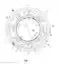 Fig. 02 - Medico-Technical device for at least partially introducing into a body passage