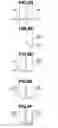 Fig. 09 - Medical device system for determining contact between first medical device and second medical device