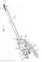 Fig. 02 - Method and apparatus for removal of tissue