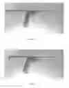 Fig. 02 - MORSELIZER