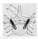 Fig. 01 - Method, Implant & Instruments for Percutaneous Expansion of the Spinal Canal