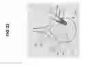 Fig. 23 - Method, Implant & Instruments for Percutaneous Expansion of the Spinal Canal