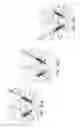 Fig. 31 - Method, Implant & Instruments for Percutaneous Expansion of the Spinal Canal