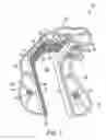 Fig. 02 - ORTHOPAEDIC CUTTING TOOL HAVING A CHEMICALLY ETCHED METAL INSERT AND METHOD OF MANUFACTURING