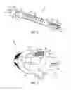 Fig. 08 - ORTHOPAEDIC CUTTING TOOL HAVING A CHEMICALLY ETCHED METAL INSERT AND METHOD OF MANUFACTURING