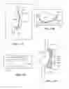 Fig. 33 - Joint arthroplasty devices and surgical tools