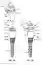 Fig. 02 - Load-sharing bone anchor having a natural center of rotation and method for dynamic stabilization of the spine