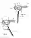 Fig. 04 - Intervertebral Connecting Device