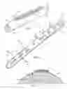 Fig. 02 - ULNAR OSTEOTOMY PLATE INCLUDING INCREASED COMPRESSION