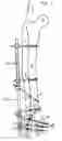 Fig. 07 - Renew compression screw