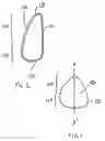 Fig. 02 - Spray method for forming shells for prostheses