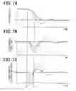 Fig. 07 - Motion control system for vehicle