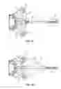 Fig. 03 - Crossbow accessory for lower receiver of rifle and related method