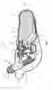 Fig. 02 - NASAL DRUG DELIVERY DEVICE AND METHOD